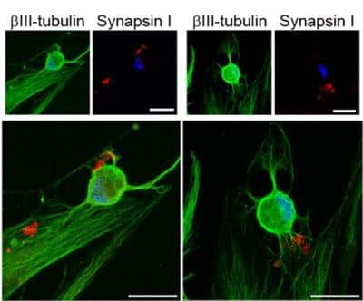 Immunocytochemistry/ Immunofluorescence: Synapsin I Antibody [NB300-104]