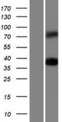 Western Blot: Synapsin I Overexpression Lysate [NBP2-10390]