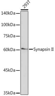 Western Blot: Synapsin II Antibody (7J6L0) [NBP3-15765]