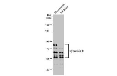 Western Blot: Synapsin II Antibody (GT1446) [NBP3-13694]