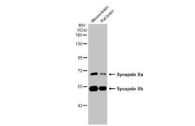 Western Blot: Synapsin II Antibody (GT387) [NBP3-13689]