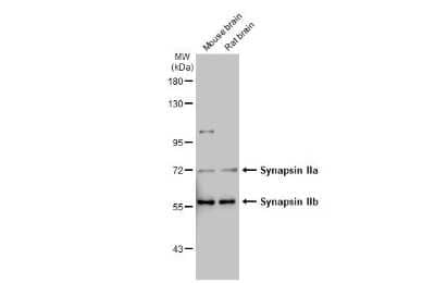 Western Blot: Synapsin II Antibody (GT763) [NBP3-13695]