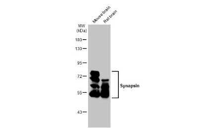 Western Blot: Synapsin II Antibody (GT965) [NBP3-13690]