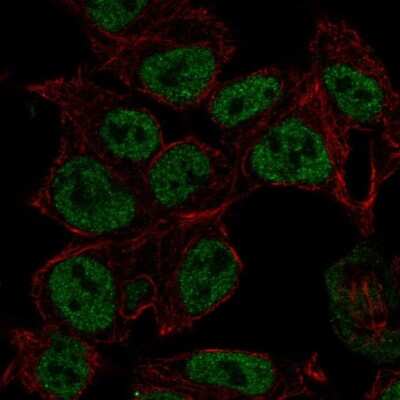 Immunocytochemistry/ Immunofluorescence: Synapsin II Antibody [NBP2-58134]