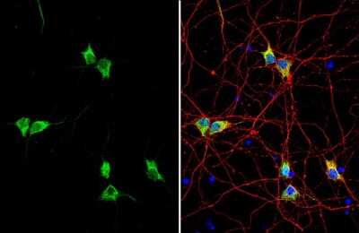 Immunocytochemistry/ Immunofluorescence: Synapsin II Antibody [NBP3-13443]