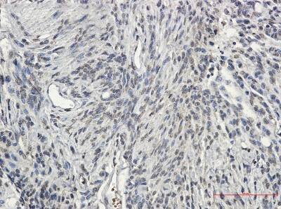 Immunohistochemistry-Paraffin: Synapsin II Antibody (S07-0I5) [NBP3-19920]
