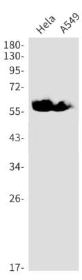 Western Blot: Synapsin II Antibody (S07-0I5) [NBP3-19920]