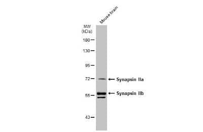 Western Blot: Synapsin II Antibody [NBP3-13443]