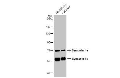 Western Blot: Synapsin II Antibody [NBP3-13445]