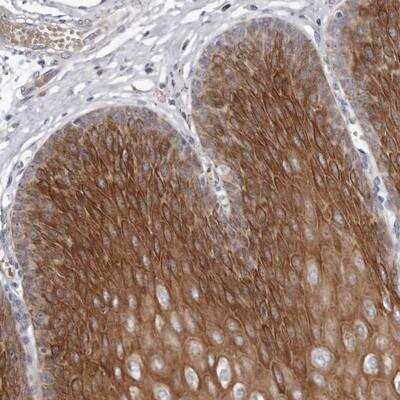 Immunohistochemistry-Paraffin: Synaptic glycoprotein SC2 Antibody [NBP1-92465]