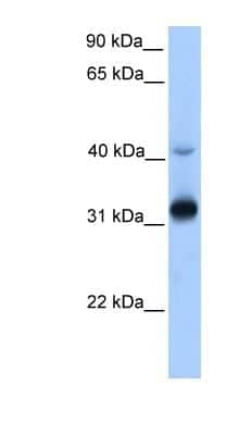 Western Blot: Synaptic glycoprotein SC2 Antibody [NBP1-60088]