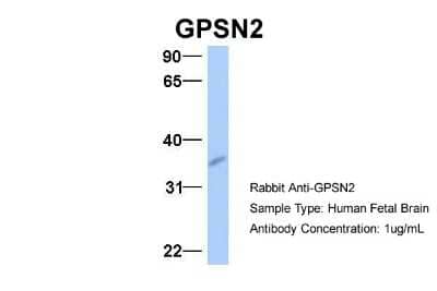 Western Blot: Synaptic glycoprotein SC2 Antibody [NBP1-60088]