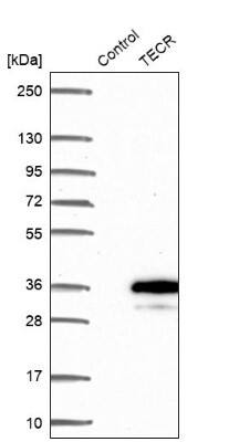 Western Blot: Synaptic glycoprotein SC2 Antibody [NBP2-49230]