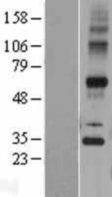 Western Blot: Synaptic glycoprotein SC2 Overexpression Lysate [NBP2-04416]