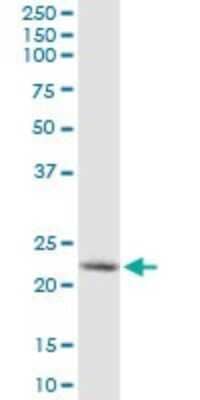 Western Blot: Synaptobrevin homolog YKT6 Antibody (1F8) [H00010652-M03]