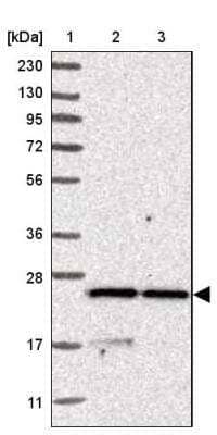 Western Blot: Synaptobrevin homolog YKT6 Antibody [NBP1-87439]