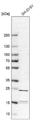 Western Blot: Synaptobrevin homolog YKT6 Antibody [NBP1-87439]