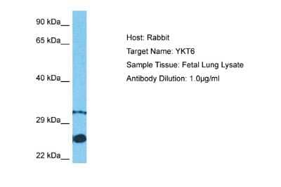 Western Blot: Synaptobrevin homolog YKT6 Antibody [NBP2-85855]