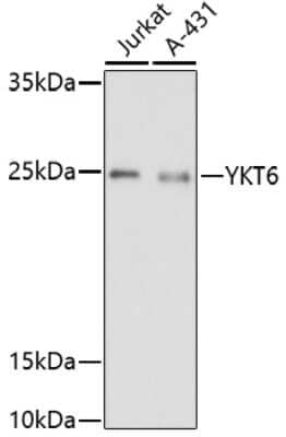 Western Blot: Synaptobrevin homolog YKT6 AntibodyAzide and BSA Free [NBP2-94847]