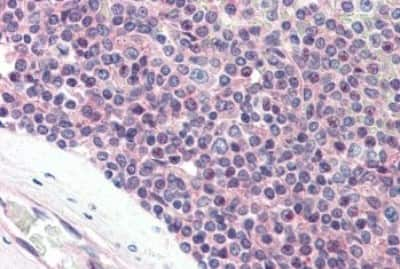 Immunohistochemistry-Paraffin: Synaptogyrin 2 Antibody [NBP3-14489]