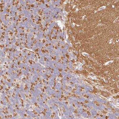 Immunohistochemistry-Paraffin: Synaptogyrin 1 Antibody [NBP1-87532]