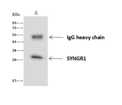 Immunoprecipitation: Synaptogyrin 1 Antibody [NBP3-06294]