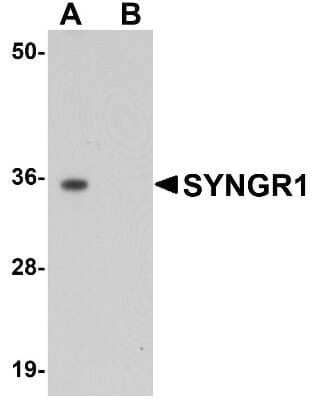 Western Blot: Synaptogyrin 1 AntibodyBSA Free [NBP1-77371]