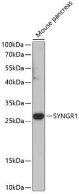 Western Blot: Synaptogyrin 1 AntibodyBSA Free [NBP2-93908]