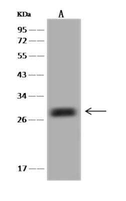 Western Blot: Synaptogyrin 1 Antibody [NBP3-06294]