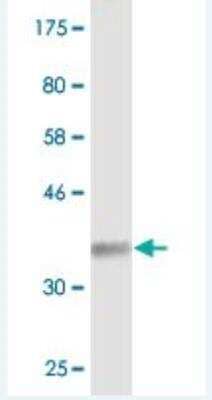 Western Blot: Synaptogyrin 2 Antibody (1G7) [H00009144-M03]