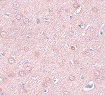 Immunohistochemistry-Paraffin: Synaptogyrin 2 Antibody - BSA Free [NBP1-77101]