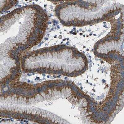Immunohistochemistry-Paraffin: Synaptogyrin 2 Antibody [NBP2-13403]