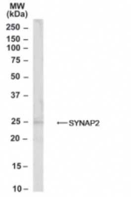 Western Blot: Synaptogyrin 2 Antibody [NB100-1490]