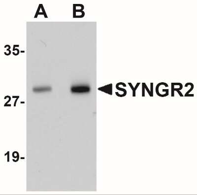 Western Blot: Synaptogyrin 2 AntibodyBSA Free [NBP1-77101]