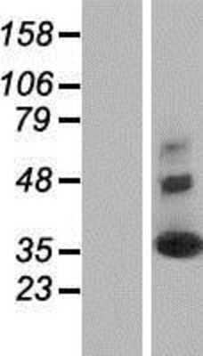 Western Blot: Synaptogyrin 2 Overexpression Lysate [NBP2-10535]