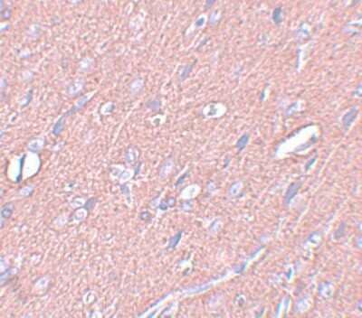 Immunohistochemistry-Paraffin: Synaptogyrin 3 Antibody - BSA Free [NBP1-77102]