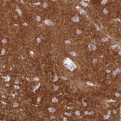 Immunohistochemistry-Paraffin: Synaptogyrin 3 Antibody [NBP2-30475]