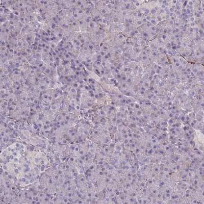 Immunohistochemistry-Paraffin: Synaptogyrin 3 Antibody [NBP2-30475]