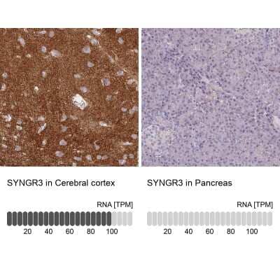 Immunohistochemistry-Paraffin: Synaptogyrin 3 Antibody [NBP2-30475]