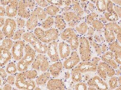 Immunohistochemistry-Paraffin: Synaptogyrin 3 Antibody [NBP3-06229]