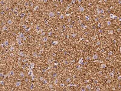 Immunohistochemistry-Paraffin: Synaptogyrin 3 Antibody [NBP3-06229]