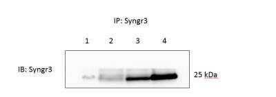 Immunoprecipitation: Synaptogyrin 3 Antibody [NBP2-30475]