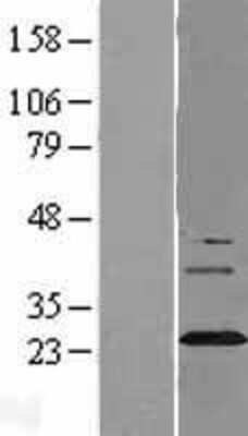 Western Blot: Synaptogyrin 3 Overexpression Lysate [NBL1-16641]