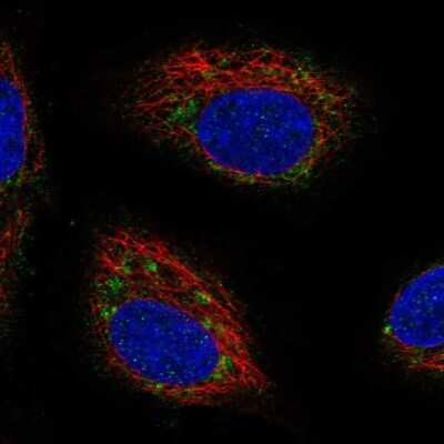 Immunocytochemistry/ Immunofluorescence: Synaptogyrin 4 Antibody [NBP2-34124]