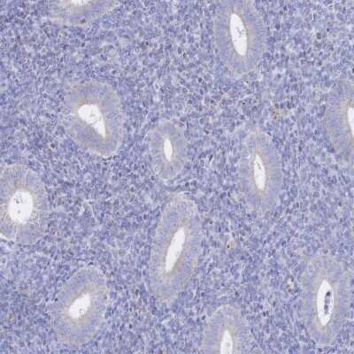Immunohistochemistry-Paraffin: Synaptogyrin 4 Antibody [NBP2-34124]