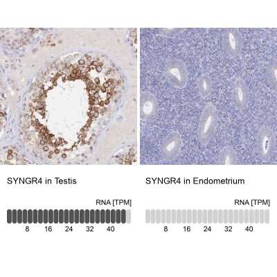Immunohistochemistry-Paraffin: Synaptogyrin 4 Antibody [NBP2-34124]