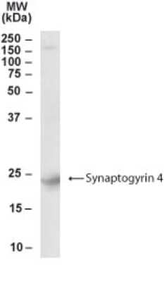 Western Blot: Synaptogyrin 4 Antibody [NB300-984]