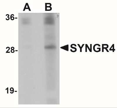 Western Blot: Synaptogyrin 4 AntibodyBSA Free [NBP1-77103]