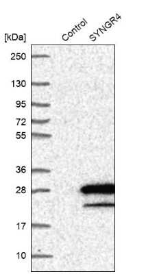 Western Blot: Synaptogyrin 4 Antibody [NBP1-87530]