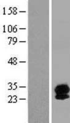 Western Blot: Synaptogyrin 4 Overexpression Lysate [NBP2-10351]